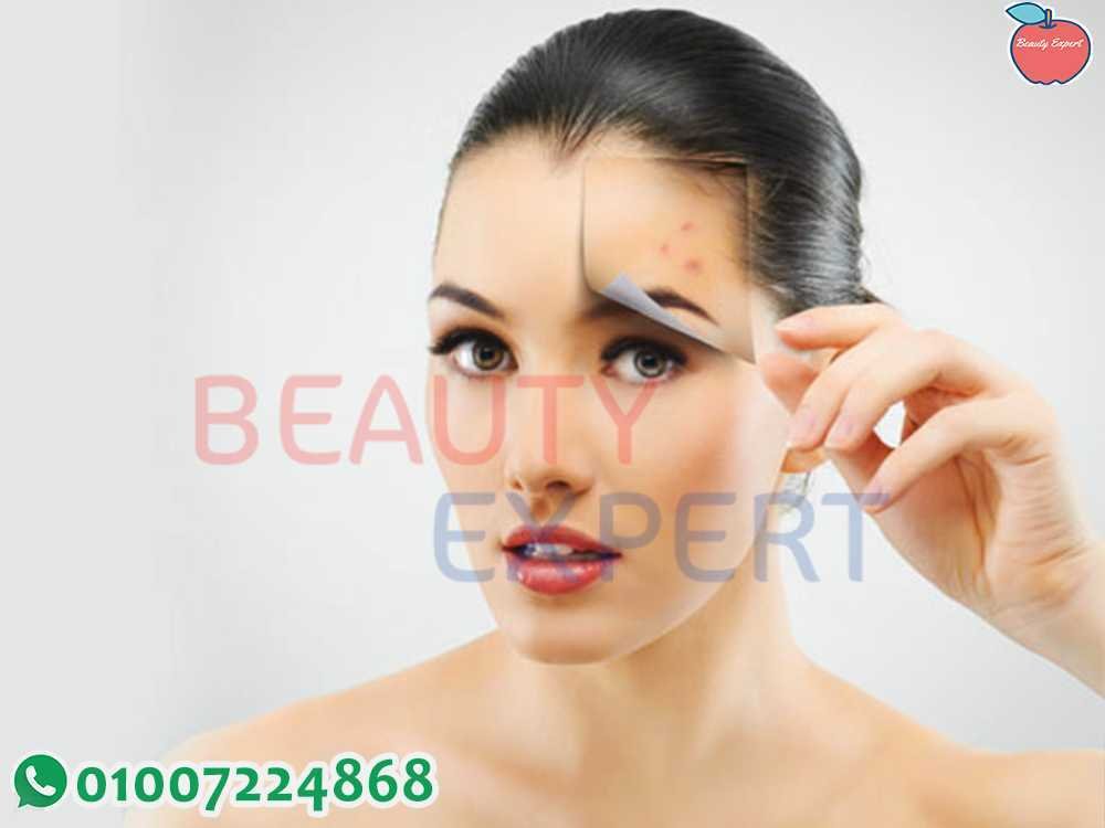 علاج البقع الداكنة