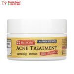 مرهم الكبريت لعلاج حب الشباب